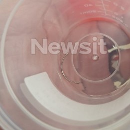 https://www.newsit.gr/ellada/mia-xeirourgiki-velona-ksexasmeni-stin-koilia-gia-sxedon-tessera-xronia-o-efialtis-pou-ligo-eleipse-na-kostisei-mia-zoi/4791752/